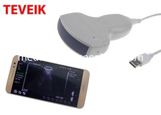 Medizinische drahtlose Ultraschall-Sonde Teveik tragbare Wifi-Ultraschall-Doppler-Maschine