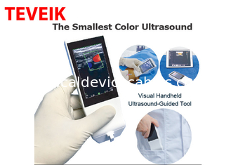 Tragbare drahtlose Ultraschall-Sonde medizinische Wifi-Ultraschall-Maschinen-Androids linear