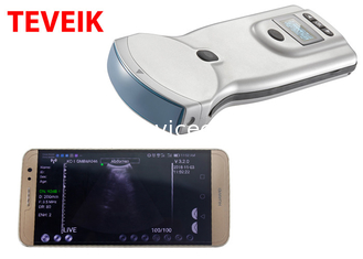 Niedriger Preis-drahtlose Ultraschall-Sonde mobile Gyne-Ultraschall-Maschine